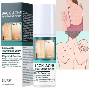 10 best sales Sırt sivilce spreyi - №7