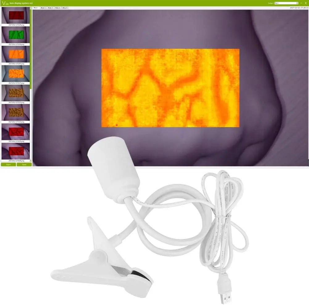 Infrared Vein finder Viewer Transilluminator  Vein Finder Display Machine Lights Imaging Vein Finder Adult Baby Vein