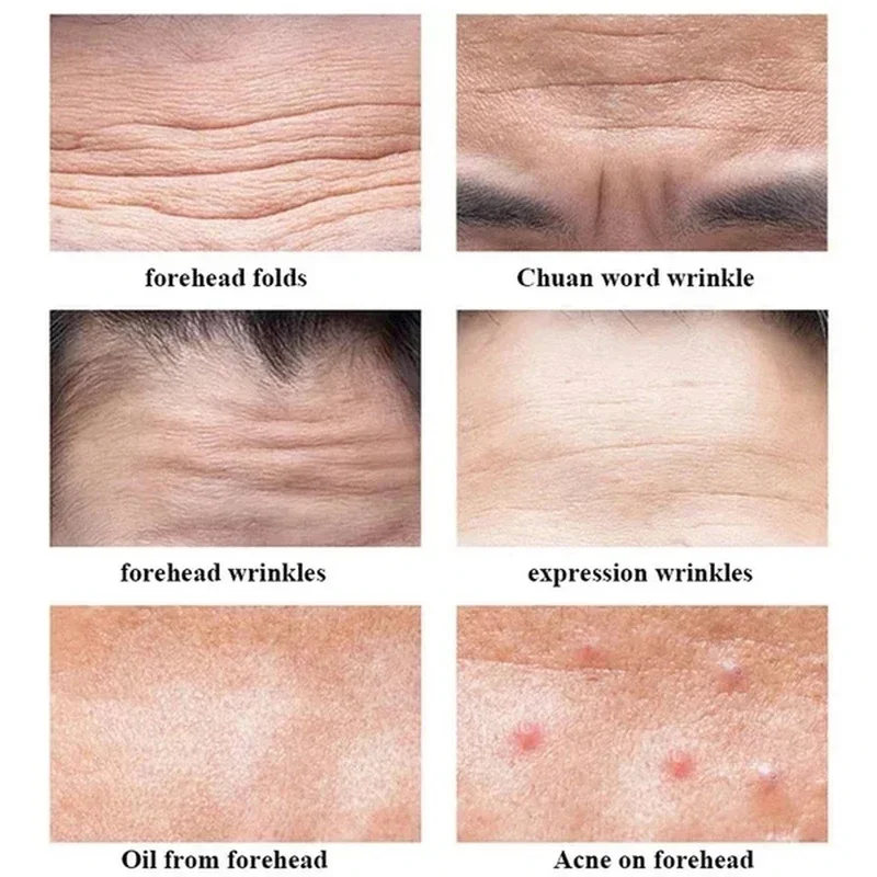 Magic Anti-wrinkle Forehead Line Removal Gel Patch Firm Mask Frown Lines Face Skin Care Treatment Stickers Anti-aging Moisturize