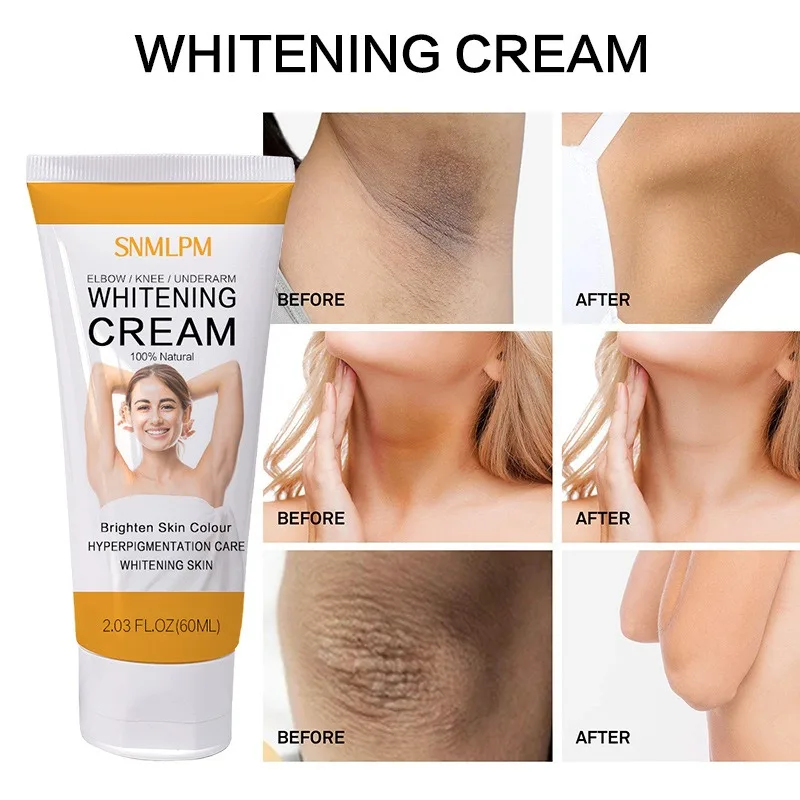 

60ML Effectiive Private Parts Underarm Whitening Cream Arm Thigh Body Knees Whitening Brighten Skin Mild Non-irritating