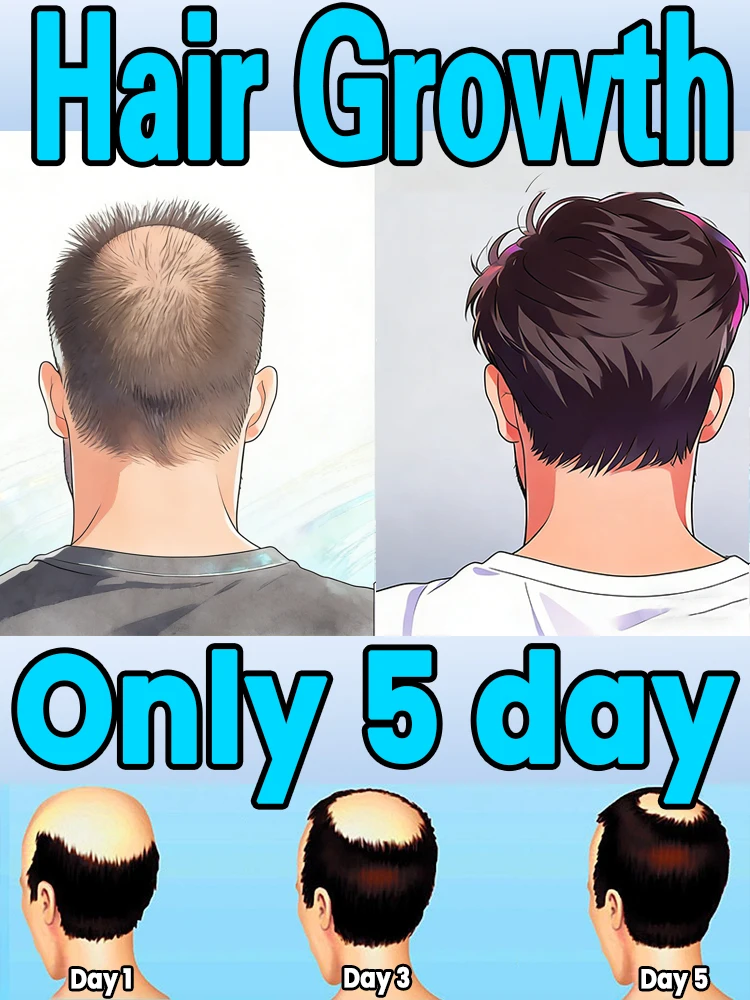 

Питайте корни волос с помощью этого популярного премиального спрея для волос, который помогает при истончении волос и создает объем и пышность.