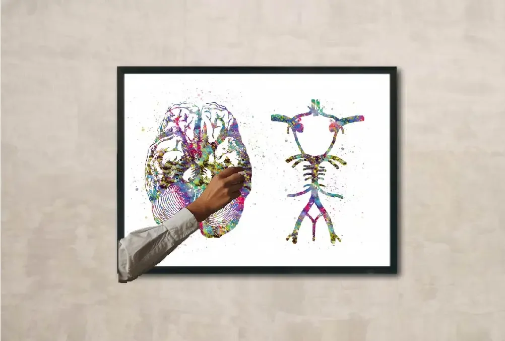 Watercolor Human Anatomy Poster Prints Canvas Painting Medical Circle of Willis Wall Art Pictures Doctor Clinic Home Room Decor