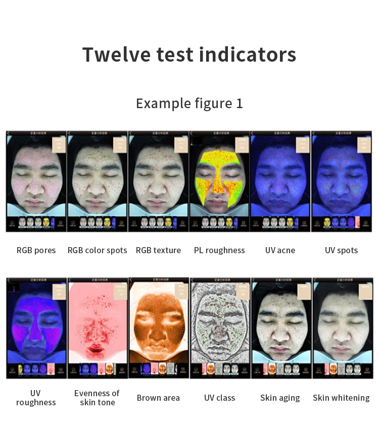 Spa Clinic Use Medical Skin Analyzer Skin and Scalp Analyzer Portable Digital Facial Skin Analyzer Machine 2024 Hot Sale