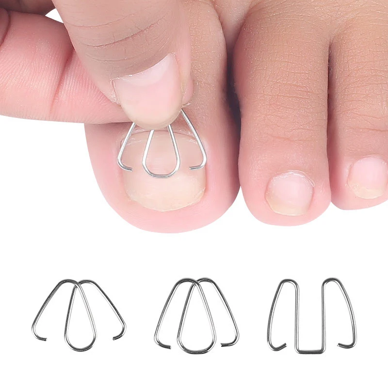 Corrector de uñas encarnadas para el cuidado de los pies, Clips de alisado de alambre, herramientas de corrección de las uñas de los pies, gancho fijador para las uñas de los pies