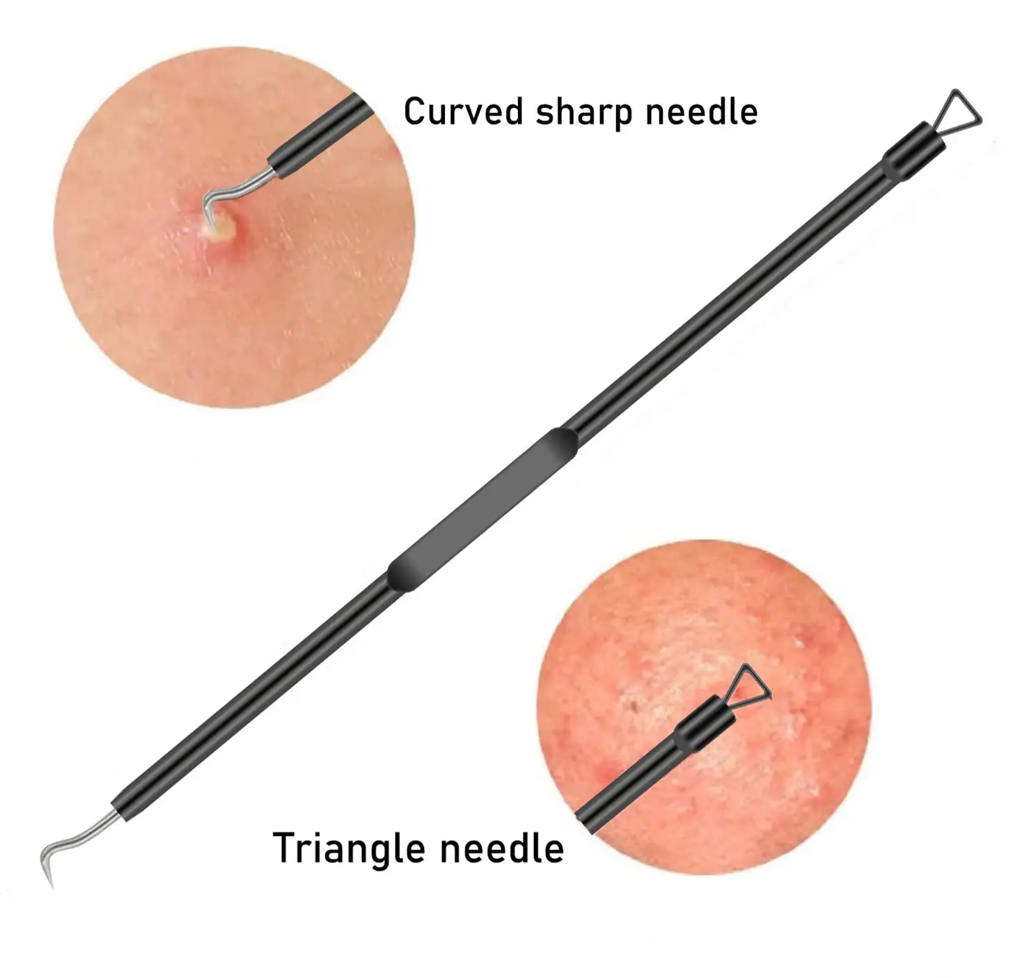 Ensemble d'aiguilles professionnelles pour points noirs du visage, extracteur de points blancs d'acné en acier inoxydable, outil de nettoyage en profondeur du visage, 4