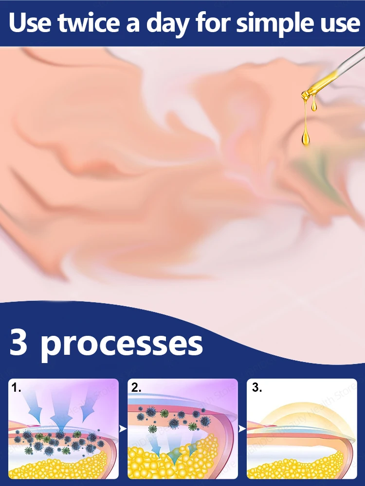 ²ⁿᵈ ᵍᵉⁿᵉʳᵃᵗⁱᵒⁿ ᵘᵖᵍʳᵃᵈᵉᵈ nᵃⁱˡ ᵒⁱˡ⸴ ʳᵉᵖaⁱʳ ⁿᵃiˡ rᵒᵒᵗ ᶠᵒˡˡⁱᶜˡᵉˢ⸴ ᑫᵘⁱᶜᵏˡʸ