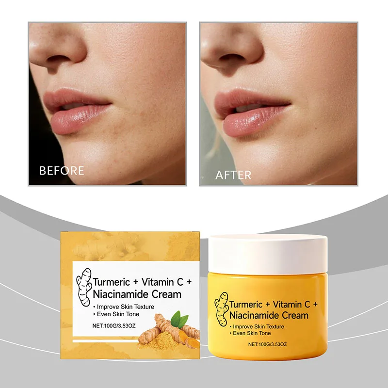 

Niacinamide Face Cream Turmeric Extract Reduce Dark Spots Oil Control Long-lasting Moisturizing Smooth Soft Facial Skin Care