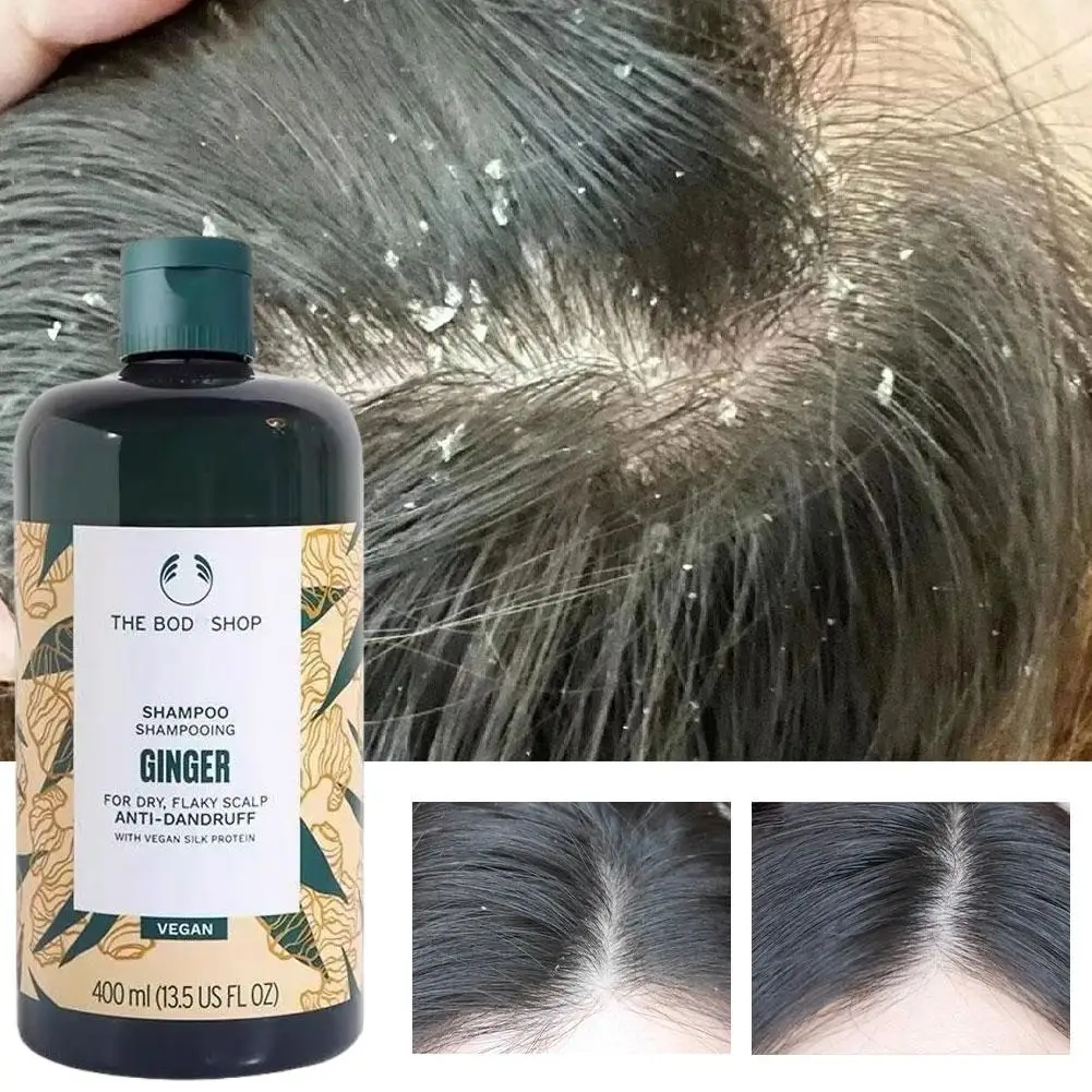 

Имбирный шампунь, травяной против перхоти, веганский, профессиональный, против выпадения волос, лапши, контроль жирности, уход за сухой кожей головы, перхоти