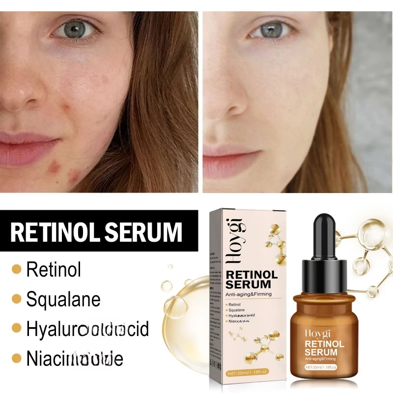 Retinol anti-wrinkle essence fade fine lines nasolabial folds remove Dullness firming moisturize brighten skin anti aging Serum