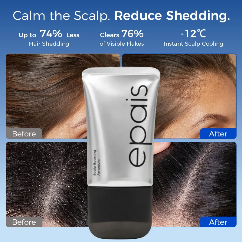 Epais Scalp Boosting Ampoule Nourishing Scalp Serum Improve Scalp Health Strengthen Hair Roots Hair Care Treatment Serum