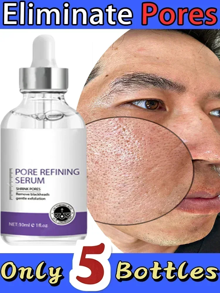 

Large Pores Removal Firming Facial Skin Improving Dull Fine Moisturizing Brightening