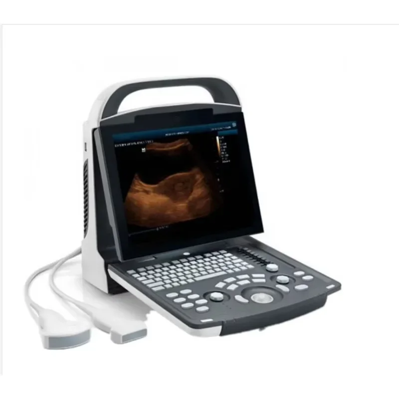 Mindray Portable Black White Ultrasound Machine DP-10