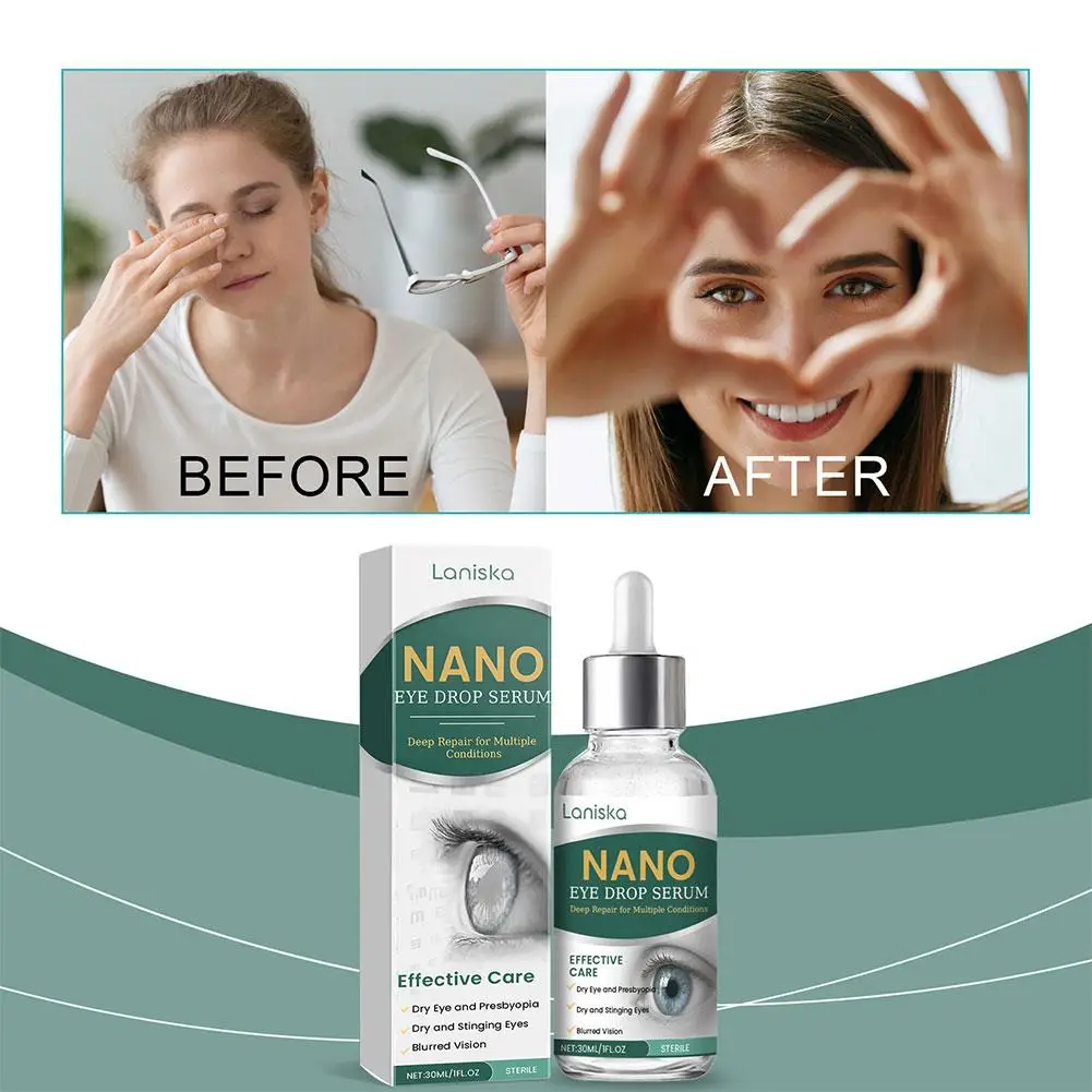 

Natural Herbal Eye Drops Relieves Eyes Discomfort Blurred Itchy Eye Care Eye Care Sore Eyes Relax Swelling Dry Brighter