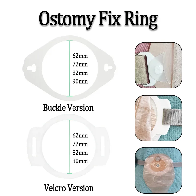 Ostomy Fixed Ring Colostomy Bag  Support Reinforcer Accessories Magic/Buckle Style--Only Fix Ring