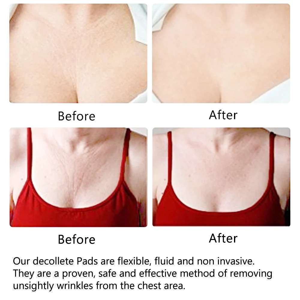 Love Chest Patches Effective Anti-wrinkle Comfortable Invisible High-quality Heart-shaped Chest Paste For Cleavage Gentle Beauty