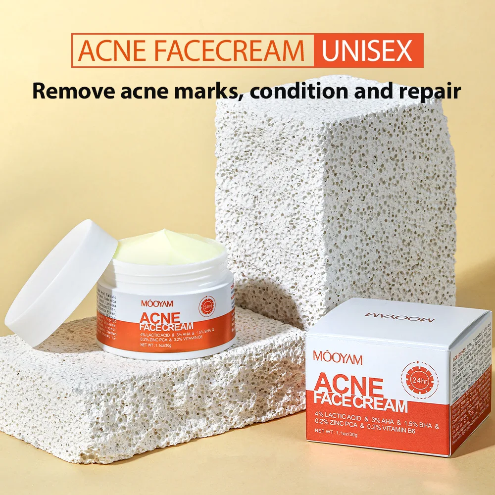 Herbal Acne Removal Face Cream Improve Acne Gel Lighten Acne Scar Pore Shrinking Eliminate Large Pores Pimples Brighten Face Car