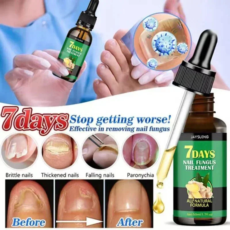 7 Day Nail Fungal Treatment Serum Foot Toe Nail Fungus Removal Essential Oil Anti Infection Onychomycosis Paronychia Repair Gel