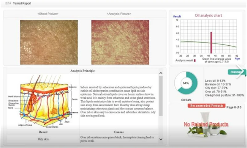 Hiszpański angielski estetyczny analizator ciała skóry i kwantowego rezonansu magnetycznego do diagnostyki skóry w salonie kosmetycznym