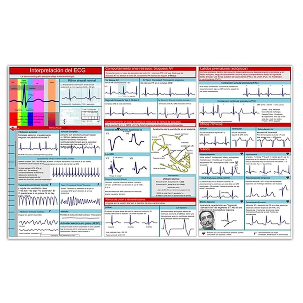 EKG Pocket Guide Double Sided EKG Rhythm Interpretation Compact Portable Reference Card for Nurse Students