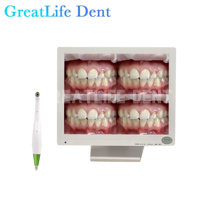 GreatLife Dent 17inch HD1600 10 LED Cold Light Hd Dental Usb Wired Intra Oral Intraoral Camera Intraoral Camera Wifi Wireless