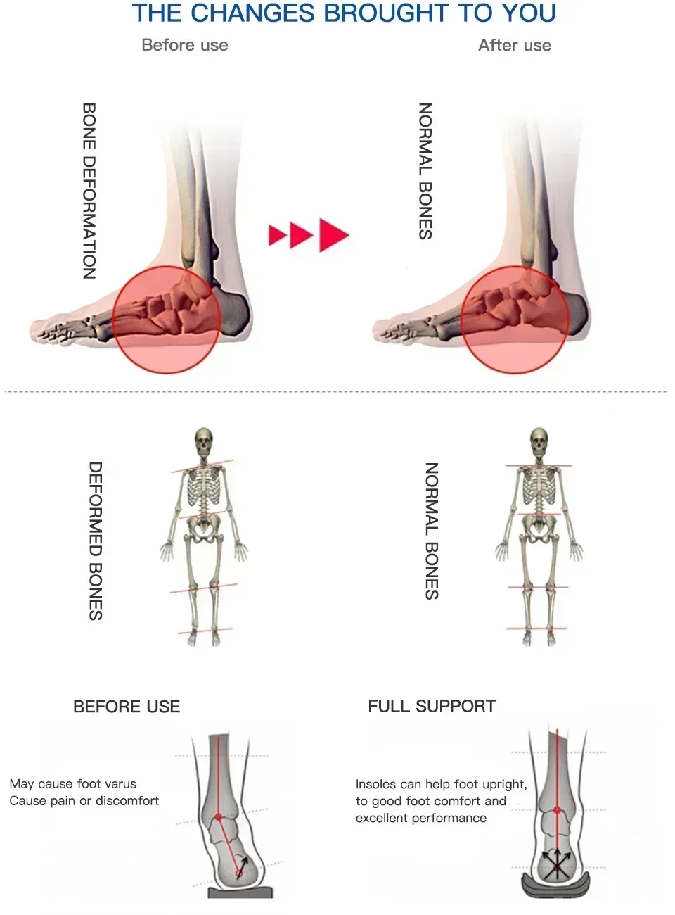 AB Professionelle Einlegesohle mit Fußgewölbestütze, Plattfußkorrektur, Schuhpolster, Orthopädische Einlage, Einlegesohlen für Fahrrad, Fußball, Laufen und Sport – Detail 6