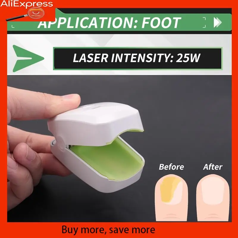 

A67Z 905NM Nail Therapeutic Instrument Portable Painless Nail Laser Therapy Device Anti-Slip Silicone Durable Easy To Use