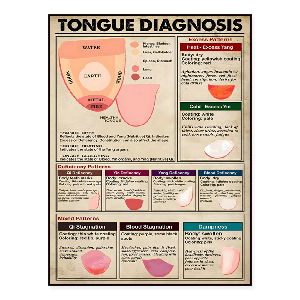 Tongue Diagnosis Poster, TCM Study Guide, Tongue Diagnosis Printing, Alternative Medicine, Acupuncture Art Poster Gift