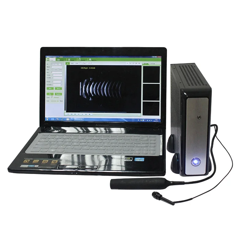 Diagnosis of ophthalmic intraocular diseases with A/B ultrasound scanner high quality low price medical ophthalmic ultrasound