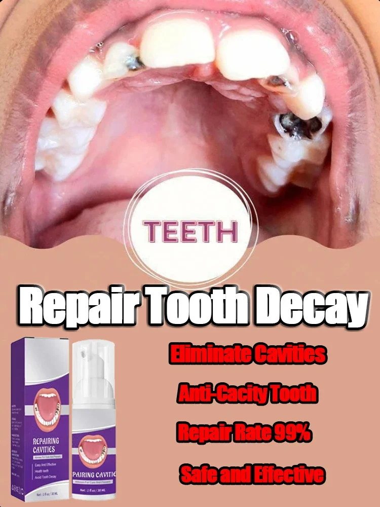 

Effective Teeth Whitening Tooth decay repair Calculus Plaque Periodontitis Remove Cavities