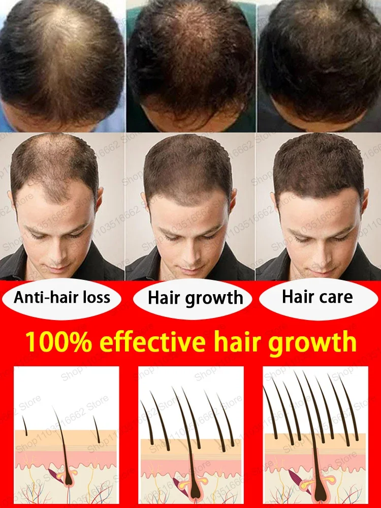 Hot selling hair growth products, fast, help, hair, grow. Fix hair loss, fix baldness.