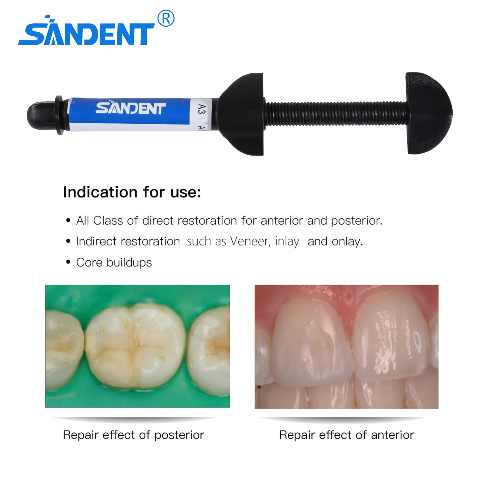 Visible Light Cure Hybrid Composite Dental Resin Based (All Shades) A2 A3