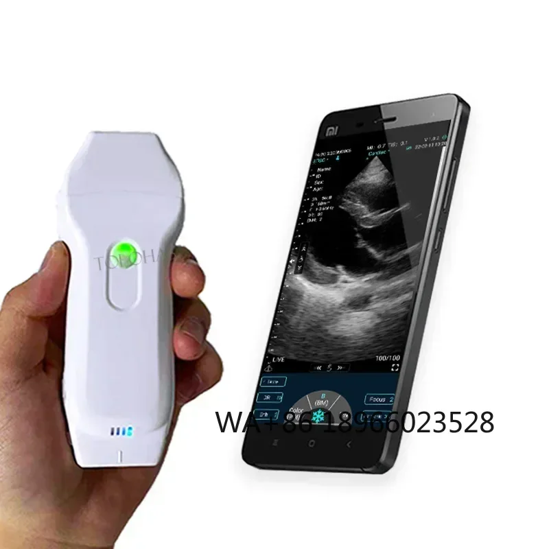 

LHA10XL Medical Ultrasound Instruments Color Doppler Wireless Usb Heart Ultrasound Probe