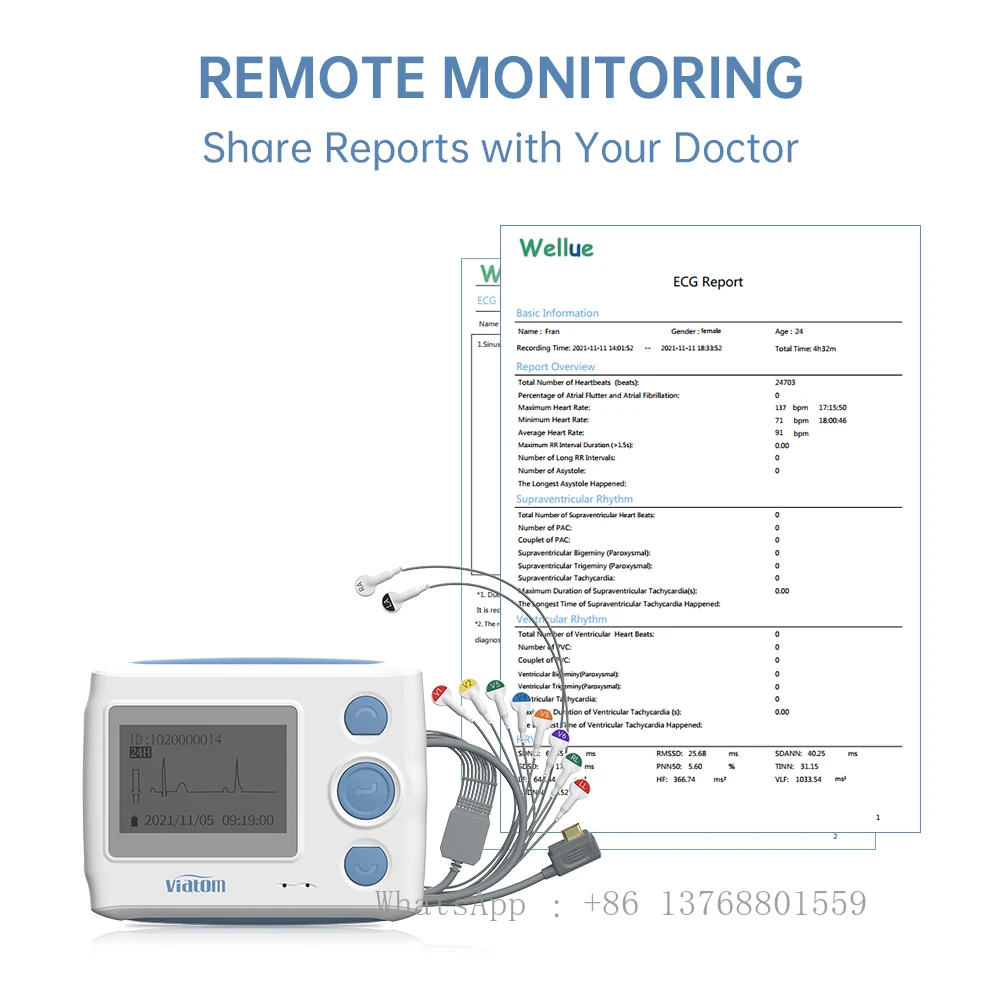 Viatom Th12 Machine 12 Channel Holter Portable Holter Recorder