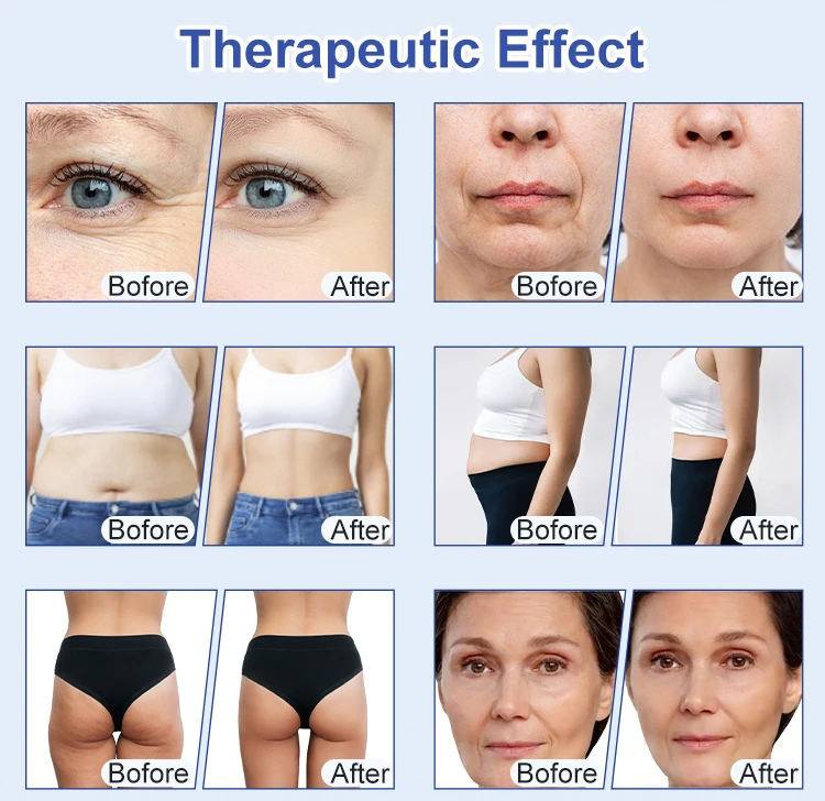 المكتبة الذكية أحدث جهاز تدليك الأسطوانة لتخفيف الوزن كافي 11 في 1 80K فراغ الثدي بعقب الوجه رفع الجسم #6