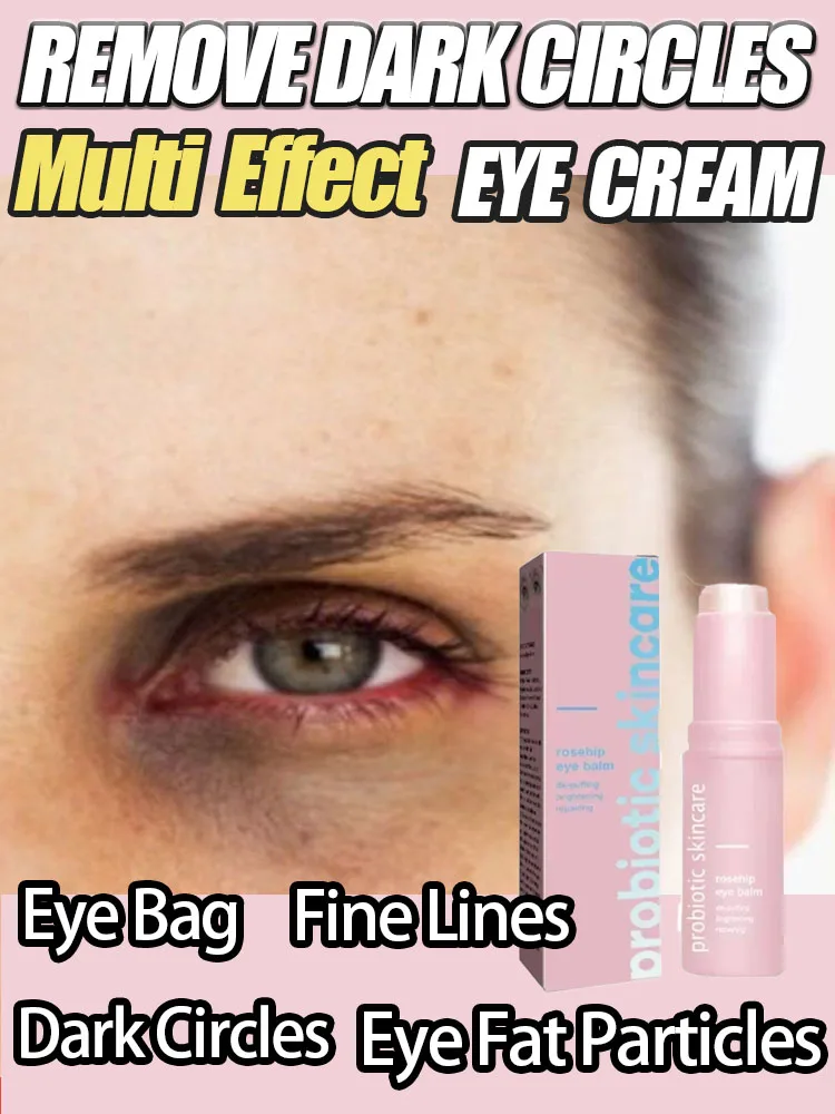 Women Extra Renewing Rosehip Eye Cream For Face Lifting Moisturizing Balm Stick Anti-Puffiness Remove Dark Circle Eye Care