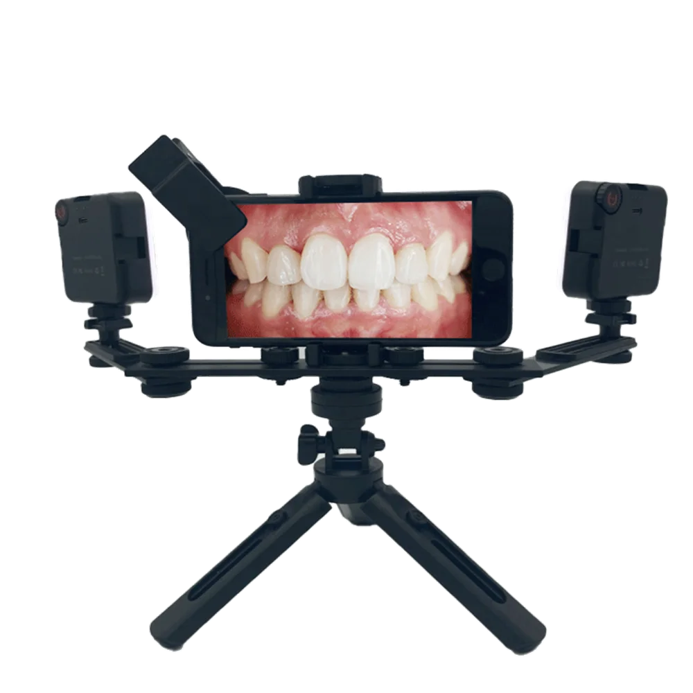 FULL MEDICAL Dental Mobile Double LED Flash Photography Holder Dental Photography Equipment with CPL for Dentist