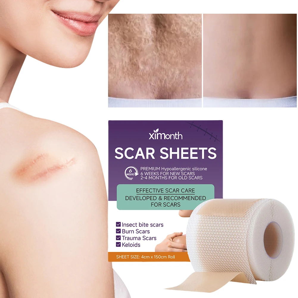 Silicone Scar Sheets Scar Patches Repair Damaged Skin Scars Covers Reduces Redness & Irritation Healing for Burn Keloid Bump