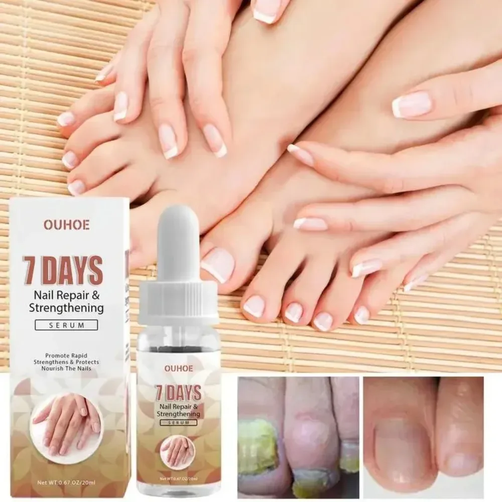 

네일 Nails Strengthener Nail Cuticle Oil Strengthener Uñas Repair Essence for Growth and Repair Toe Nail Hardener Nail Repair