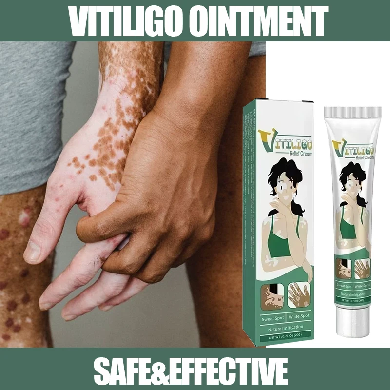 Vitiligo Ointment Ringworm Effectively Remove White Spot Removal Skin Vitiligo Eliminate Vitiligo Body Skin Care