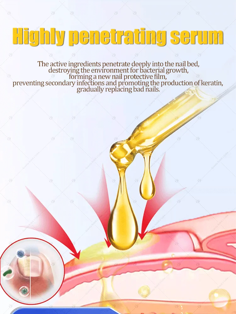 Nagelreinigingshulpmiddel, nail art stickers, vaarwel nagelproblemen