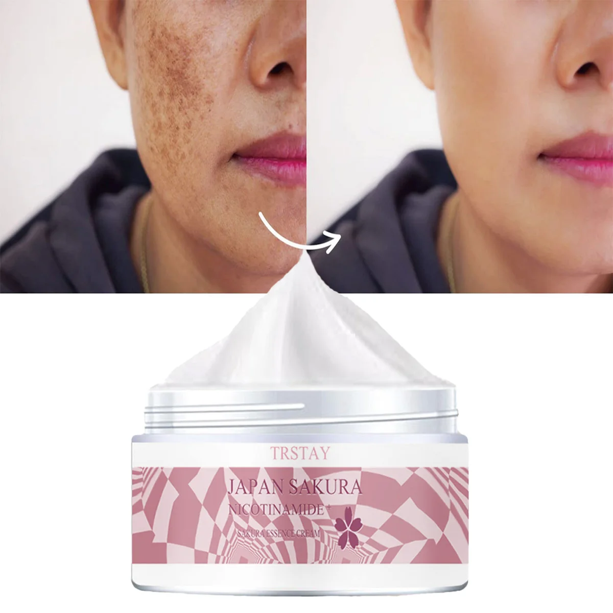 

TRSTAY Sakura Niacinamide восстанавливающий крем для лица, отбеливающий пятно для ухода за кожей для мам и детей