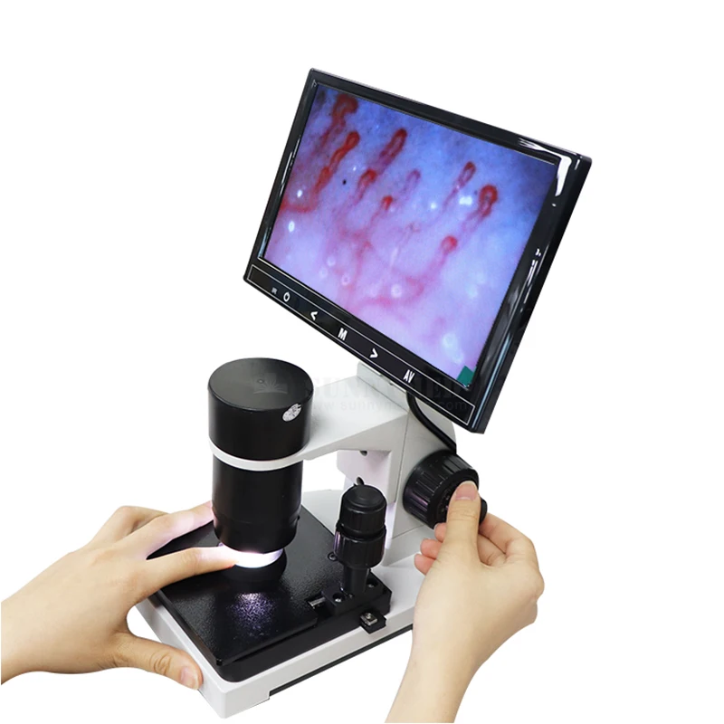 SY-B198 Portable Split Type LED screen Clinic Finger Capillary Laboratory Microscope