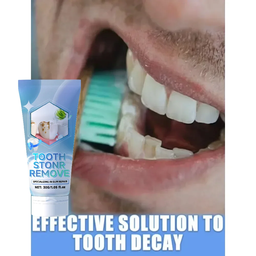 إصلاح الأسنان، ويمنع تساقط الأسنان، وإزالة لوحة الأسنان بشكل فعال #4