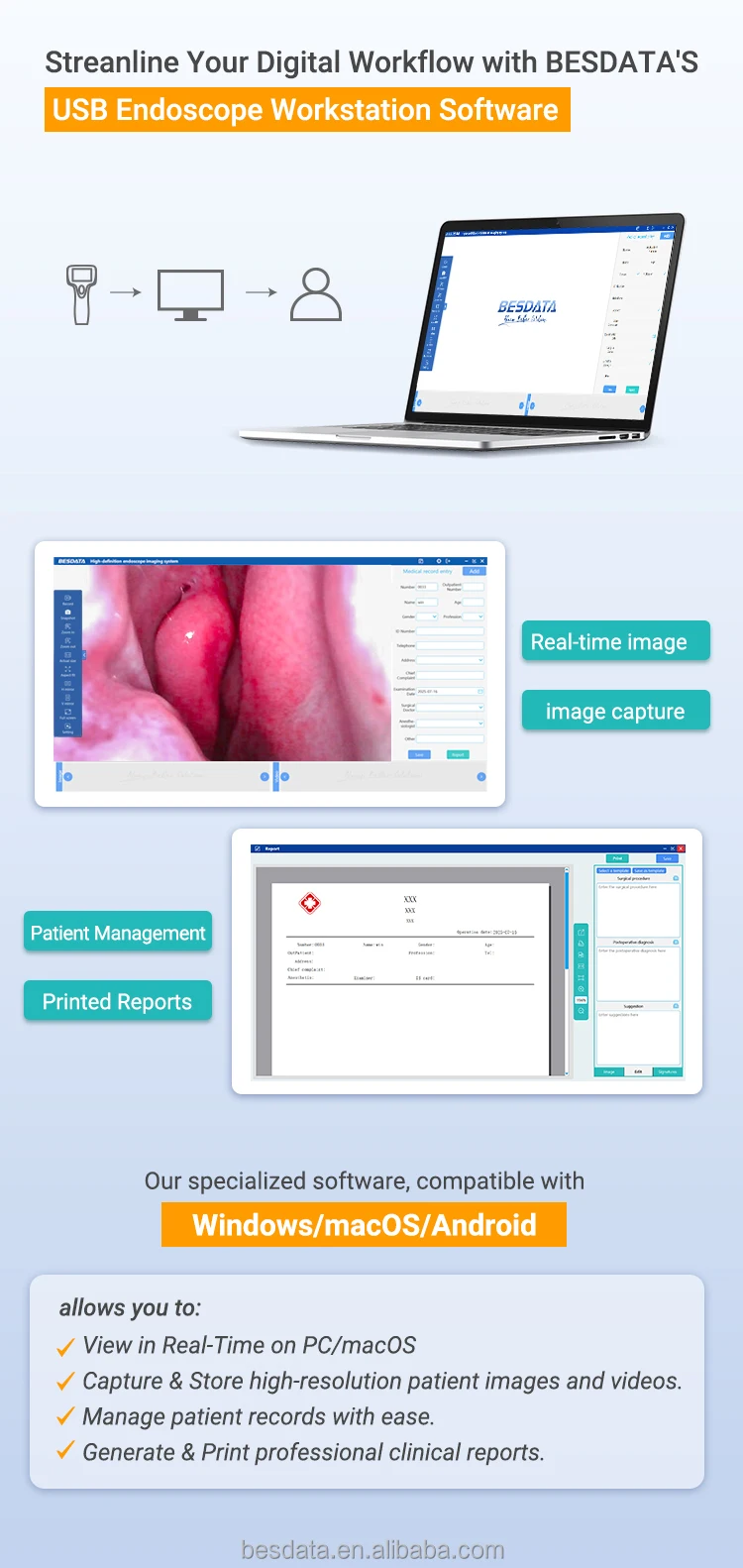 Digital LED Optic Fiber Mini Otoscope Kit BESDATA White Light Mini Video Otoscope Set Optical ENT Rigid Endoscope with Screen