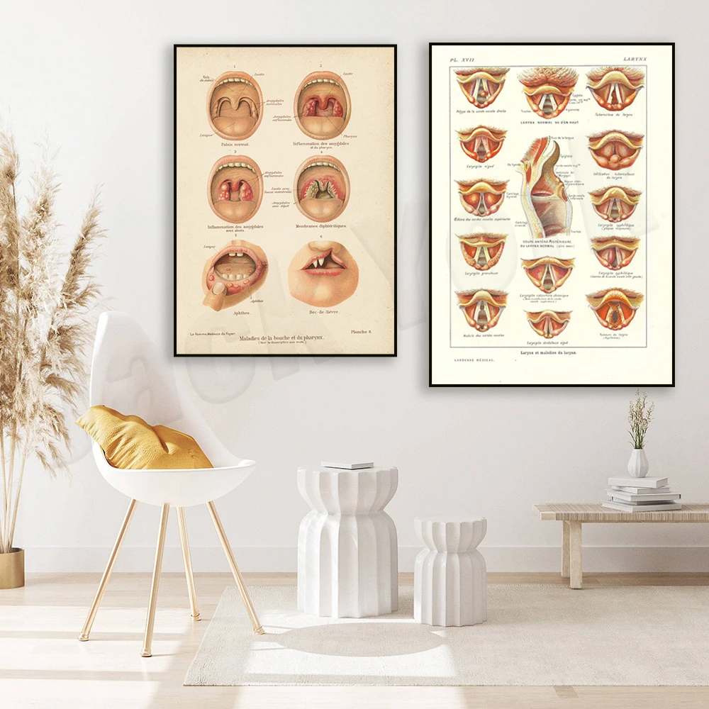 Mouth and Throat Anatomy,Little Throat Poster 1912 French Vintage Anatomy Print, Medical Gift for Otolaryngology, Medical Decor