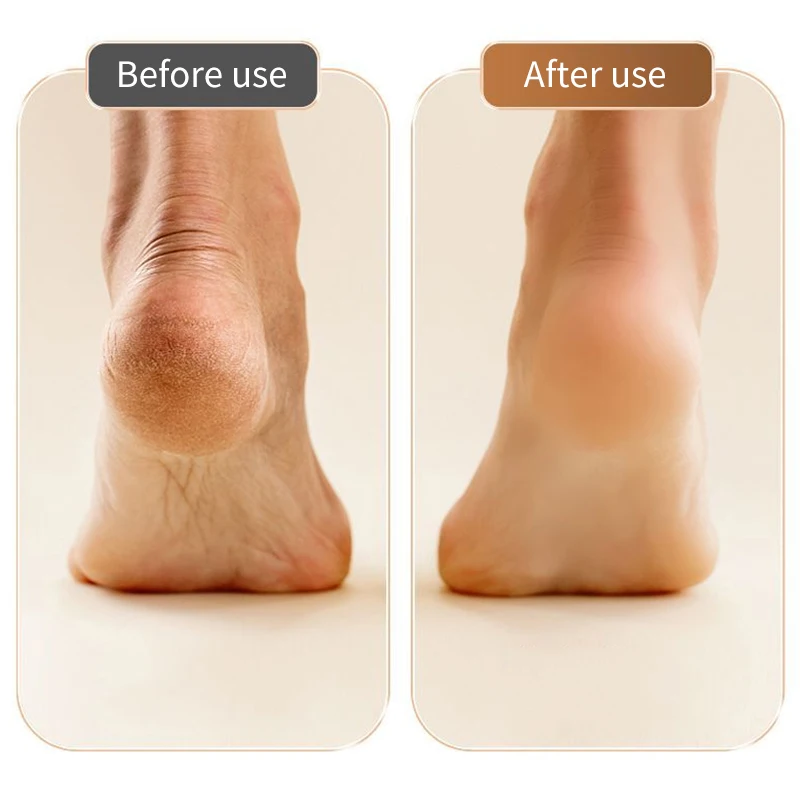 Moedor elétrico de pés, ferramenta de cuidados com os pés para remover pele morta e calosidades, máquina recarregável de cuidados com o calcanhar e pedicure