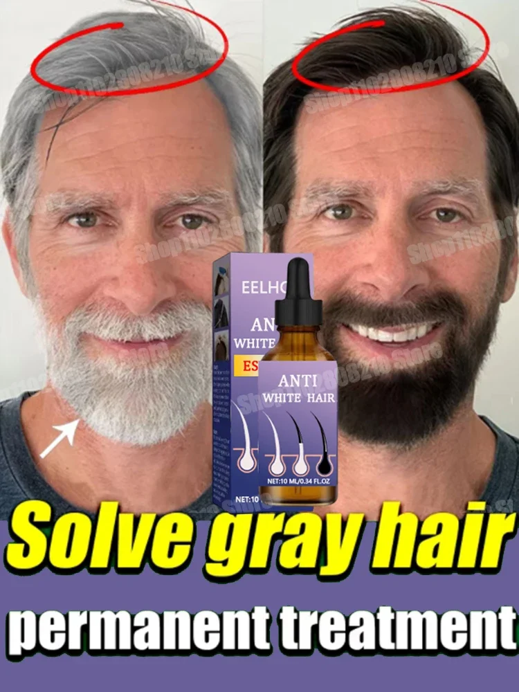 White hair killer, remove gray hair and restore natural hair color in 7 days