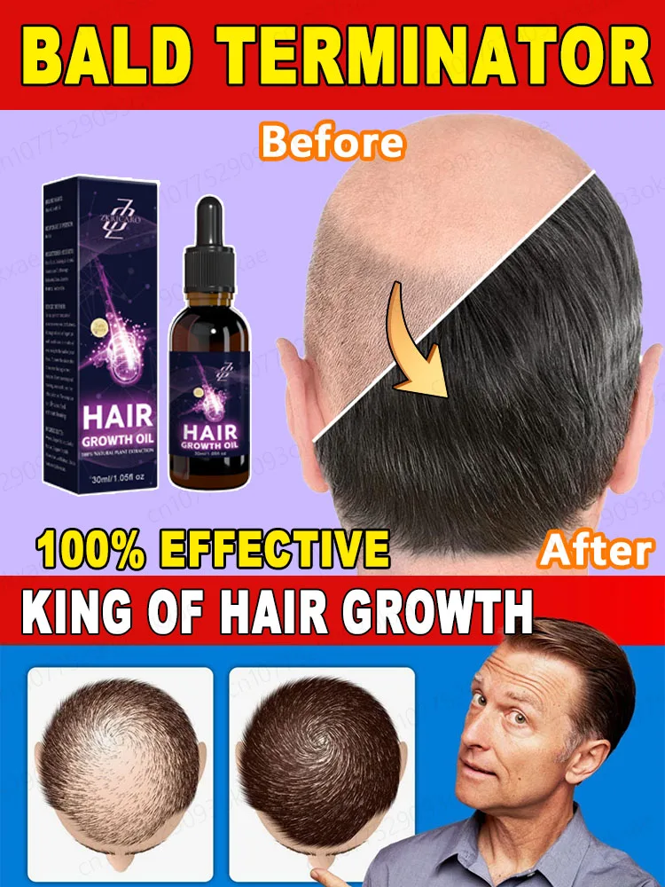 Hair growth essential oil, let hair grow freely. Repair hair follicles and hair loss