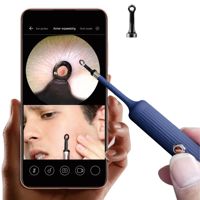 Bebird EarSight Plus Accessories Acne squeezer Picker, Stainless Pimple Squeezing Cleansing Kit For Young Men / Women Use