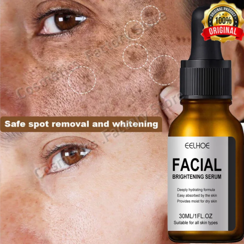 

Powerful Dark Spots Remover Whitening Serum Face Freckle Melanin Correcting Anti Pigmentation Brighten Skin Beauty Care Products